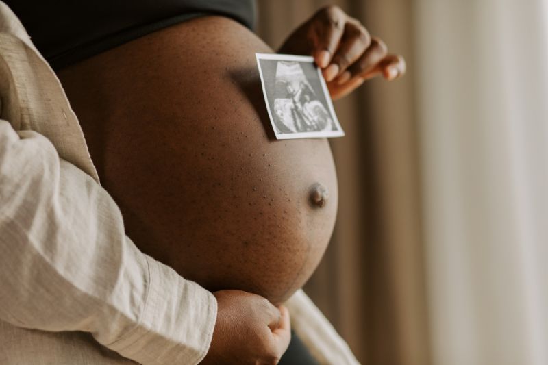 Schwangere Frau Schwangere Frau hält ein Ultraschallbild vor ihren Babybauch